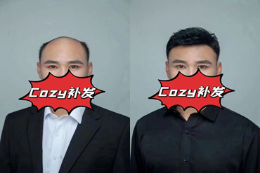 辽阳小哥织发补发后高兴的开怀大笑