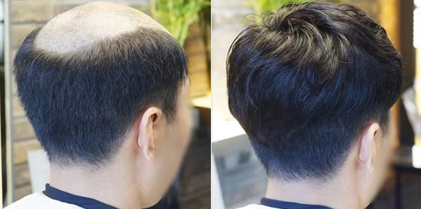 为什么有的在某东买的，都是毛坯发剪的，但总是不如实体“店的戴上去好看！