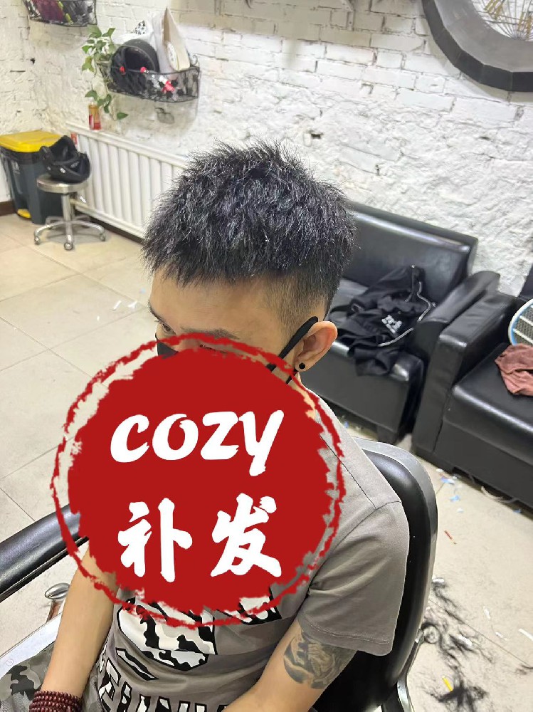 大连小伙终于不再为头发烦恼