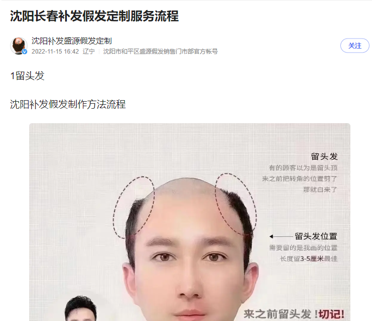 沈阳长春补发假发定制流程看这里