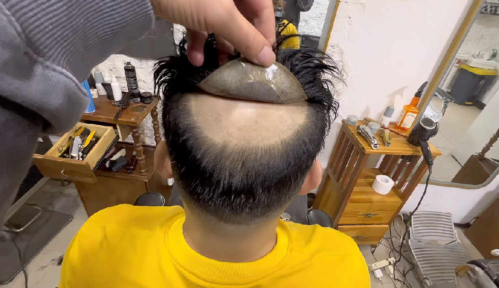长春补发织发定制假发再也不用烦恼了