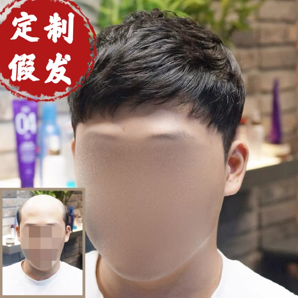 夏天用什么假发好？男士假发怎么选？