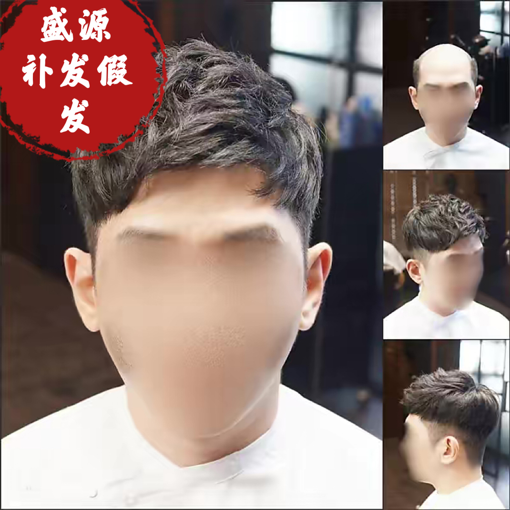 长春盛源补发织发假发定制中心