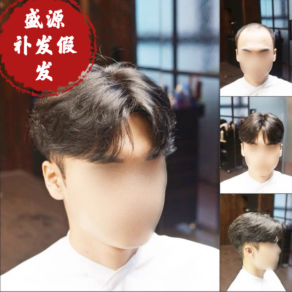 长春盛源补发织发假发定制中心