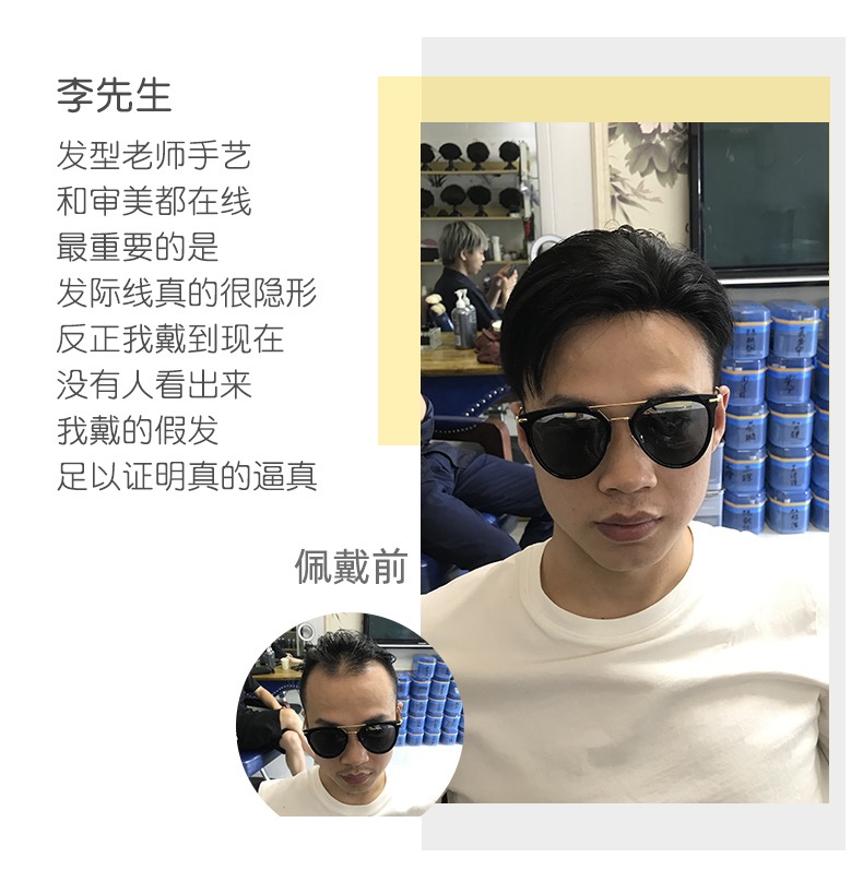 补发的时候，发型师的审美也很重要