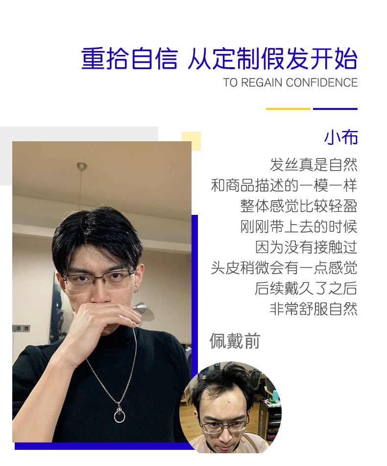 沈阳男士假发案例分享