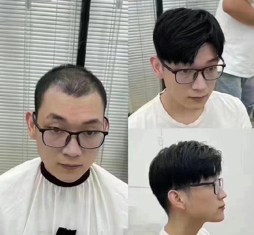 补发案例分享